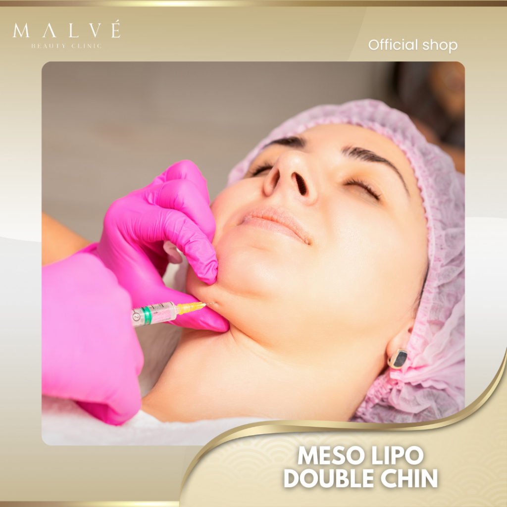 Malve Meso Lipo Double Chin