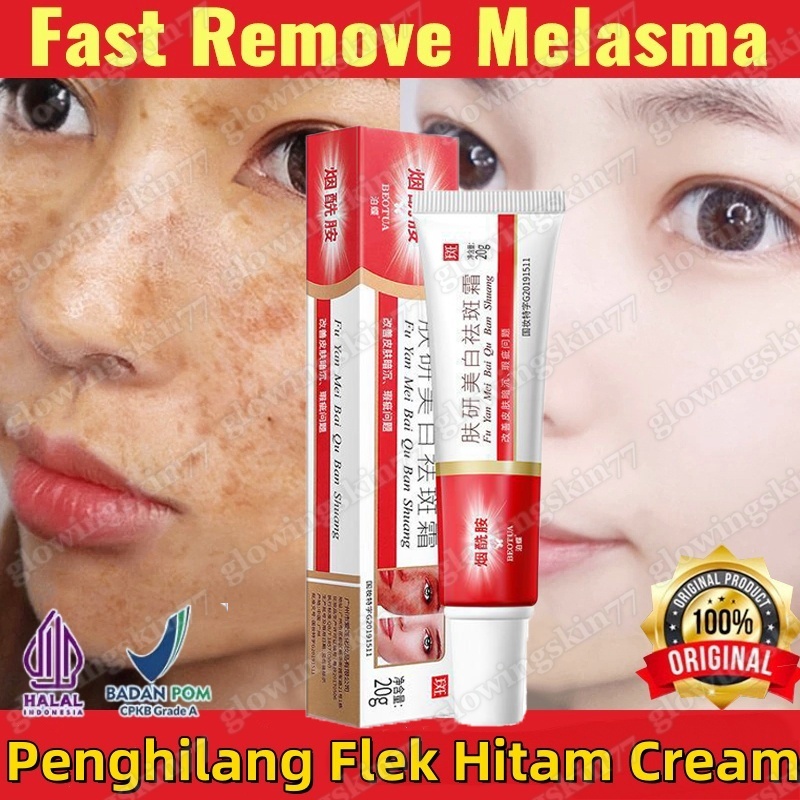 Cream Penghilang Flek Hitam Cream 20g Pemutih Wajah Niacinamide Whitening Freckle Cream Remove Melas