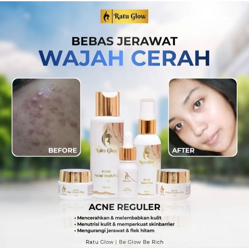 CREAM MALAM ACNE RATU GLOW ORIGINAL/NIGHT CREAM ACNE RATU GLOW  REGULER/CREAM MALAM  ACNE RATU GLOW