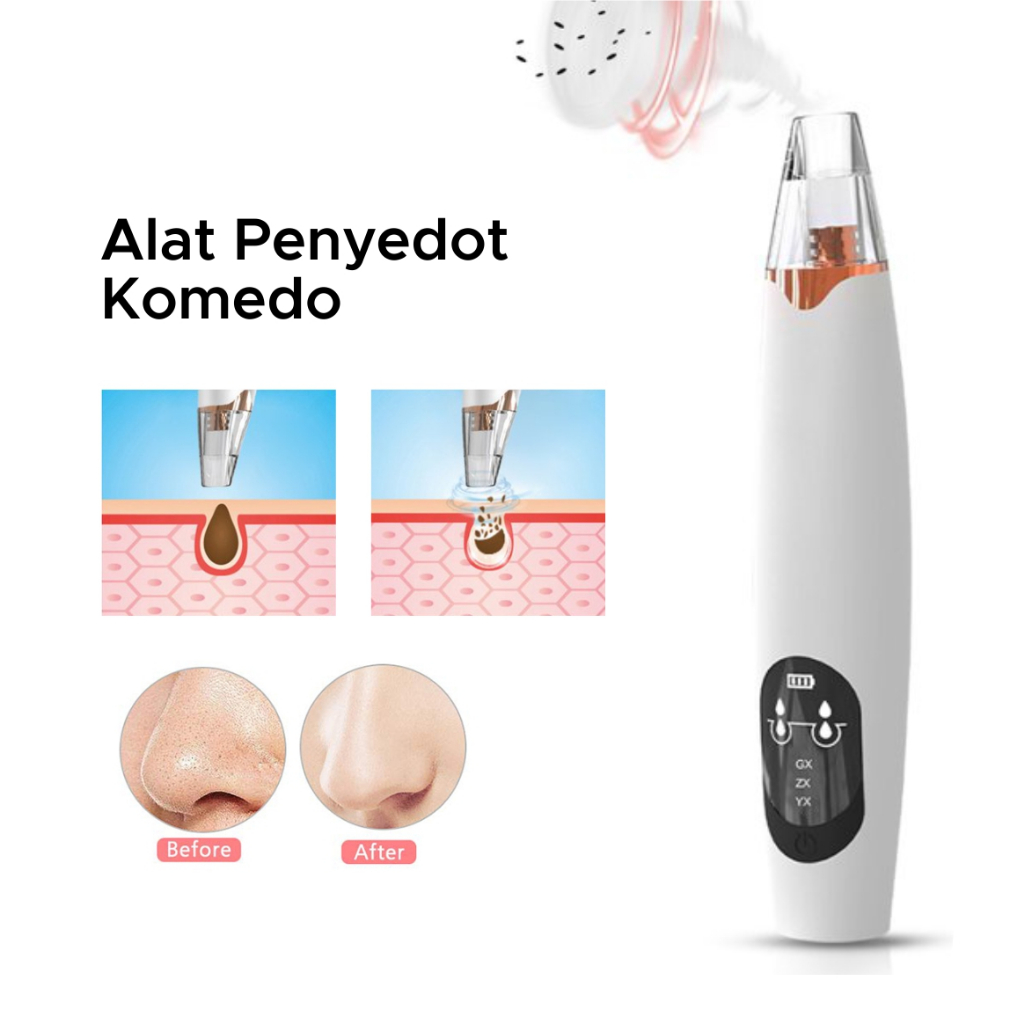 Penyedot Komedo dan Pori Pori Wajah Alat Vakum Pembersih Jerawat