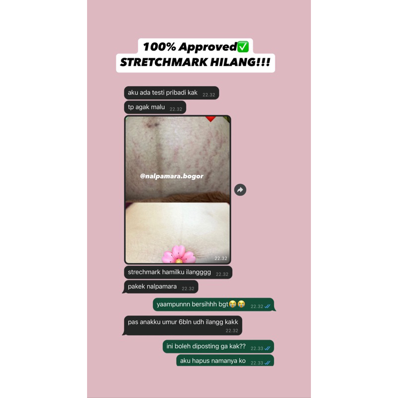 RB ORIGINAL NALPAMARA DUBAI PYARY [ORI DUBAI]