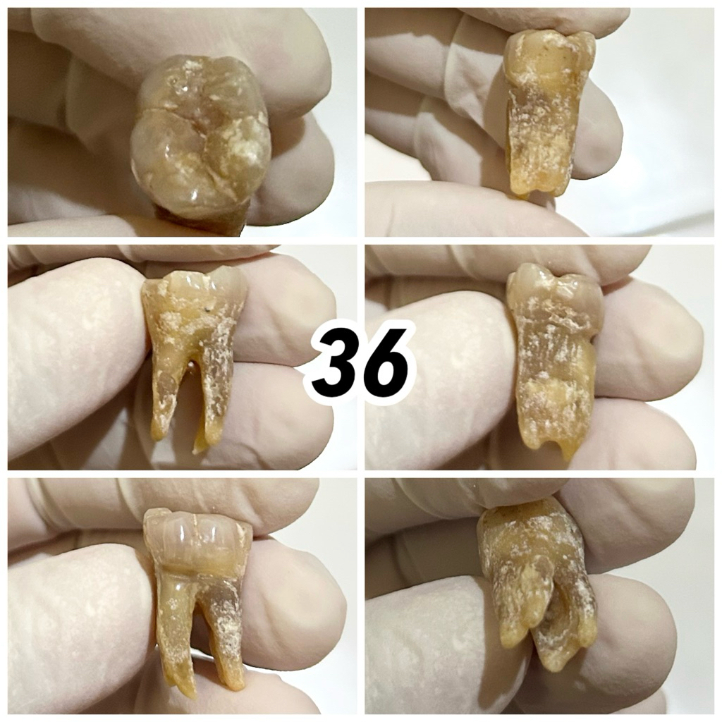 JUAL GIGI ASLI PRAKTIKUM / GIGI MANUSIA / KEDOKTERAN GIGI