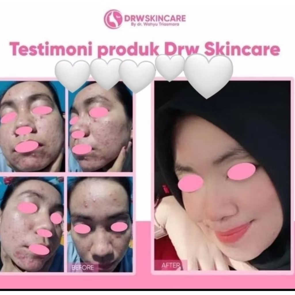 SUNSCREEN DRWSKINCARE Dr. WAHYU TRIASMARA