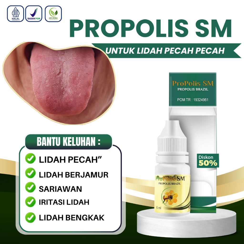 Obat Lidah Pecah Pecah, Lidah Berjamur, Obat Pembengkakan Lidah, Obat iritasi Lidah, Lidah Pecah Pec