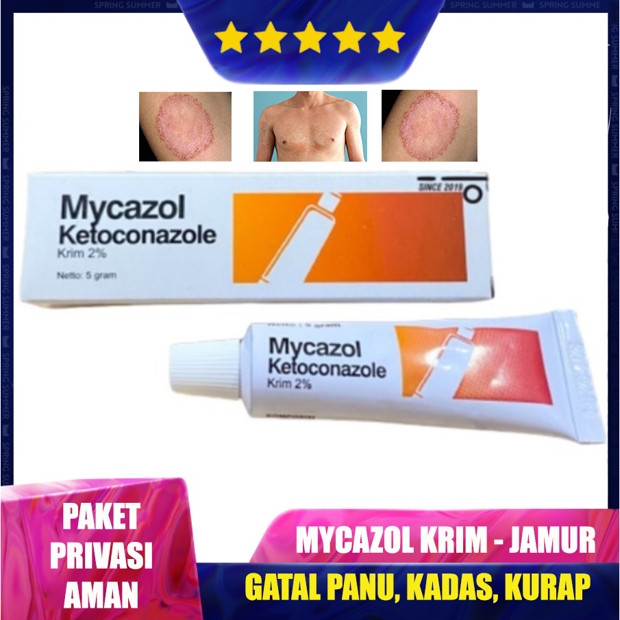 Mycazol Krim - Ketoconazole Cream Salep Gatal Jamur, Panu, Kudis & Kurap | Kulit Tangan Kaki Leher P