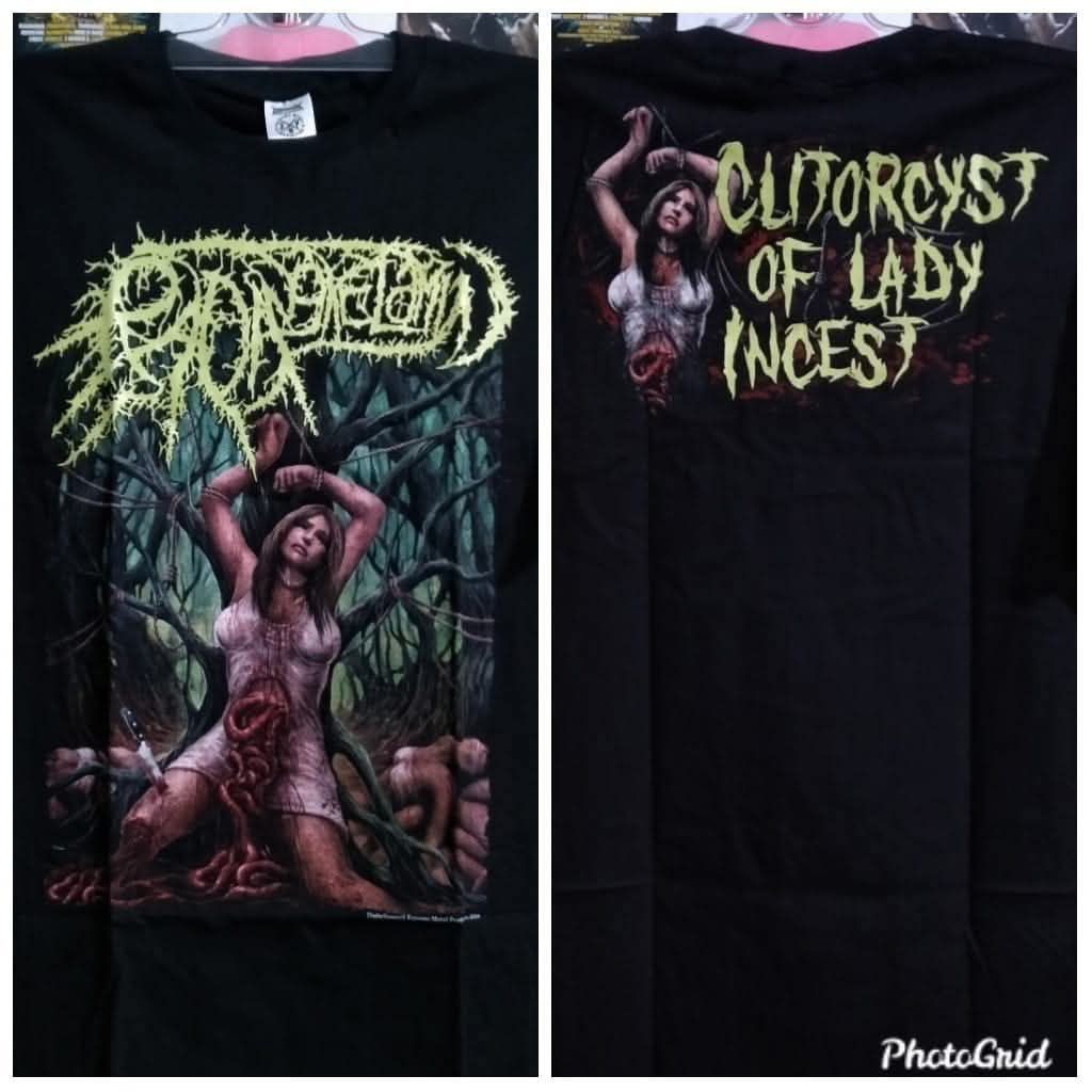 Ts radang kelamin - incest