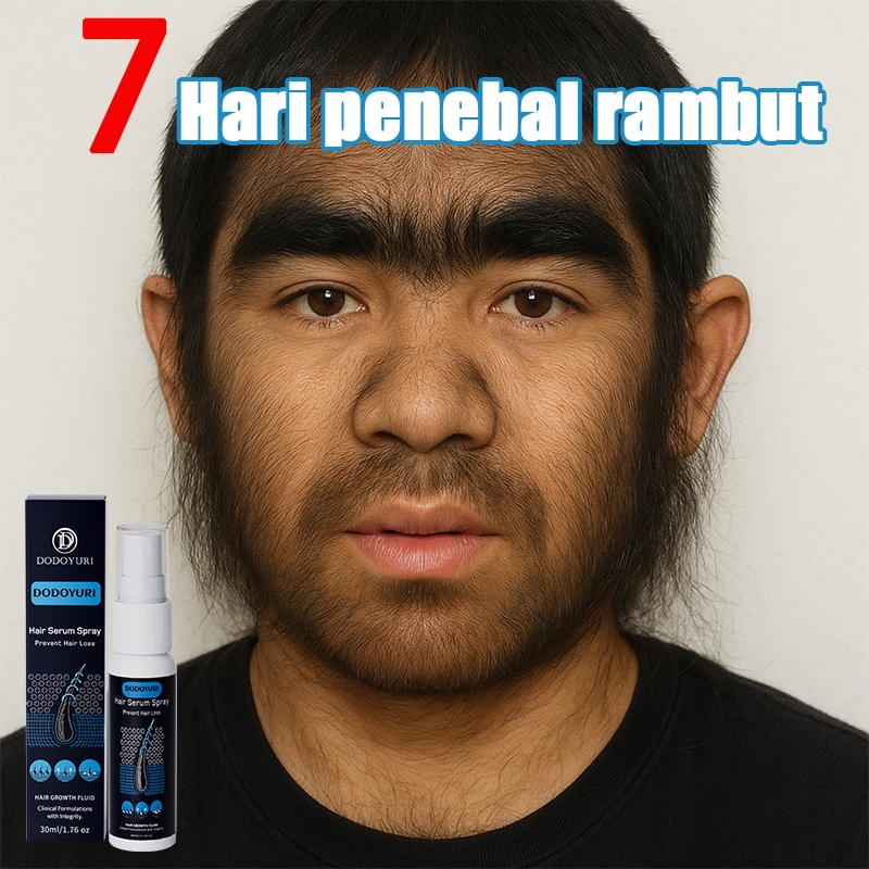 【BPOM】Serum penumbuh rambut penumbuh rambut botak penebal rambut penumbuh rambut cepat 30ml hair ton