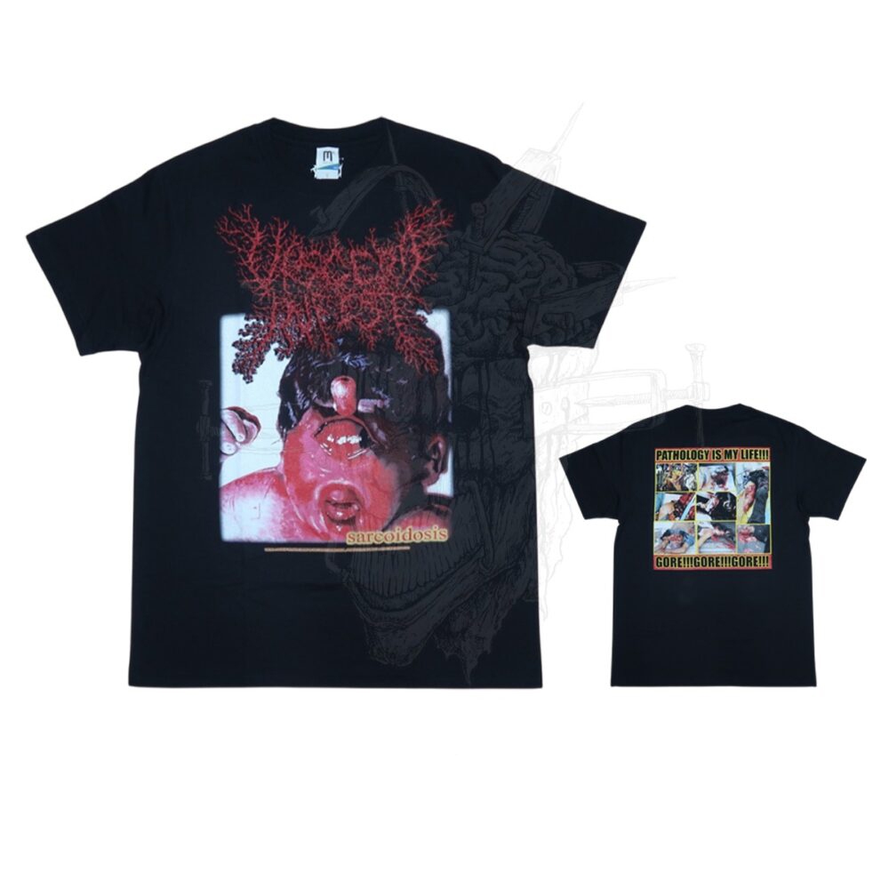 T-Shirt - Viscera Infest - Sarcoidosis