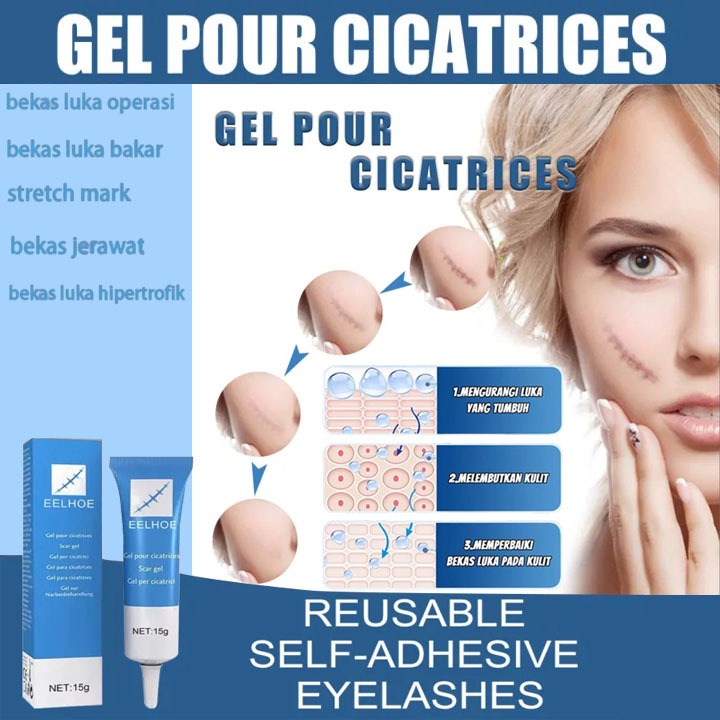 EELHOE salep bekas luka Ampuh dermatik salep penghilang bekas luka ori/obat penghilang bekas luka ko