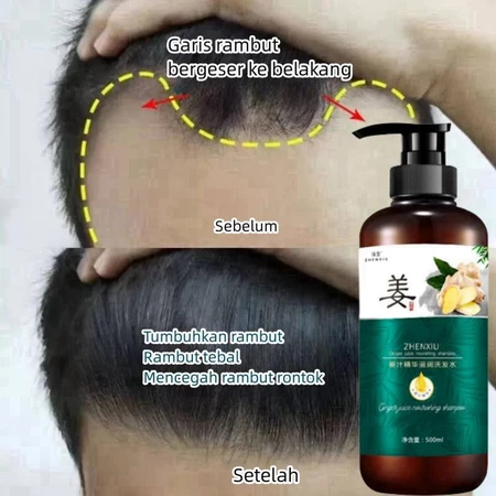 Penumbuh rambut botak Shampoo rambut rontok Sampo pemanjangan rambut cepat Penumbuh rambut cepat dan