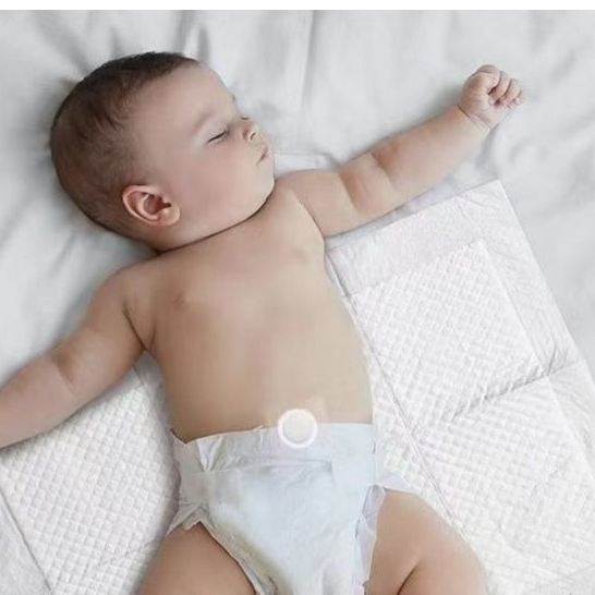 hernia patch umbilical infant Bodong Pusar Bodong Bayi Sachet Plester Pusar Bayi