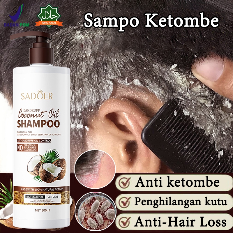 Shampo anti ketombe Shampo Kutu Rambut Ketombe Kulit Kepala Gatal Shampo 500ml Bahan Alami Cocok Ana