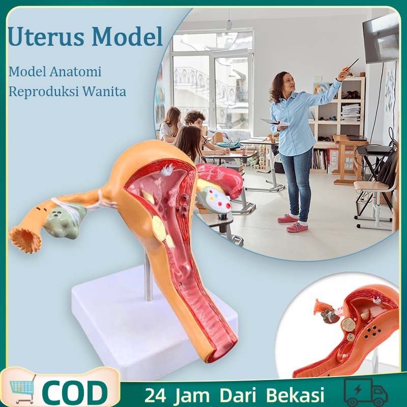 Uterus Ovary Anatomical Model/Model Patologis Uterus Ovarium/Alat Peraga Reproduksi Wanita  Anatomy/