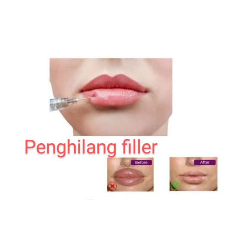 Neutralizer penghilang/penetral filler HDS