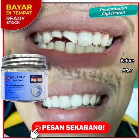 SWEETRIP Penambal Gigi Permanen Asli Temptooth Gigi Palsu Temporary Tooth DIY Repair Kit Denture Adh