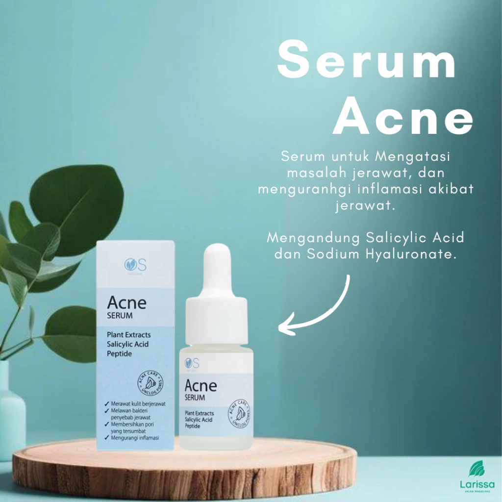 LARISSA JAMAL - PAKET ACNE KESEMBUHAN - BERJERAWAT BERMINYAK