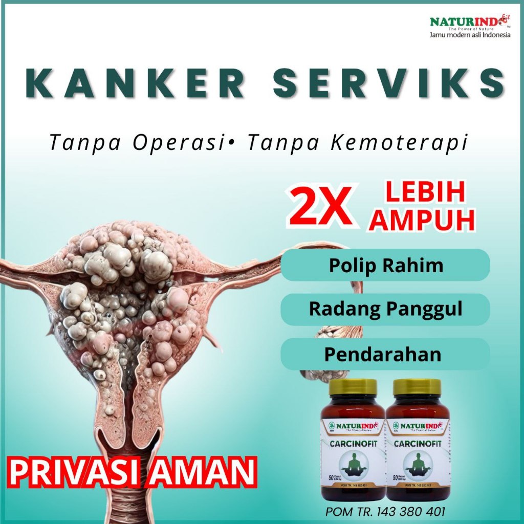 Obat Kanker Serviks Leher Rahim Tumor Polip Rahim Herbal Alami