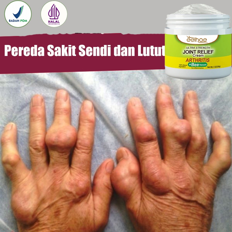 Terapi Kaki Salep Tumit Obat Sakit Tumit Plantar Fasciitis Terapi Pelindung Tumit Kaki Sakit Kemudah
