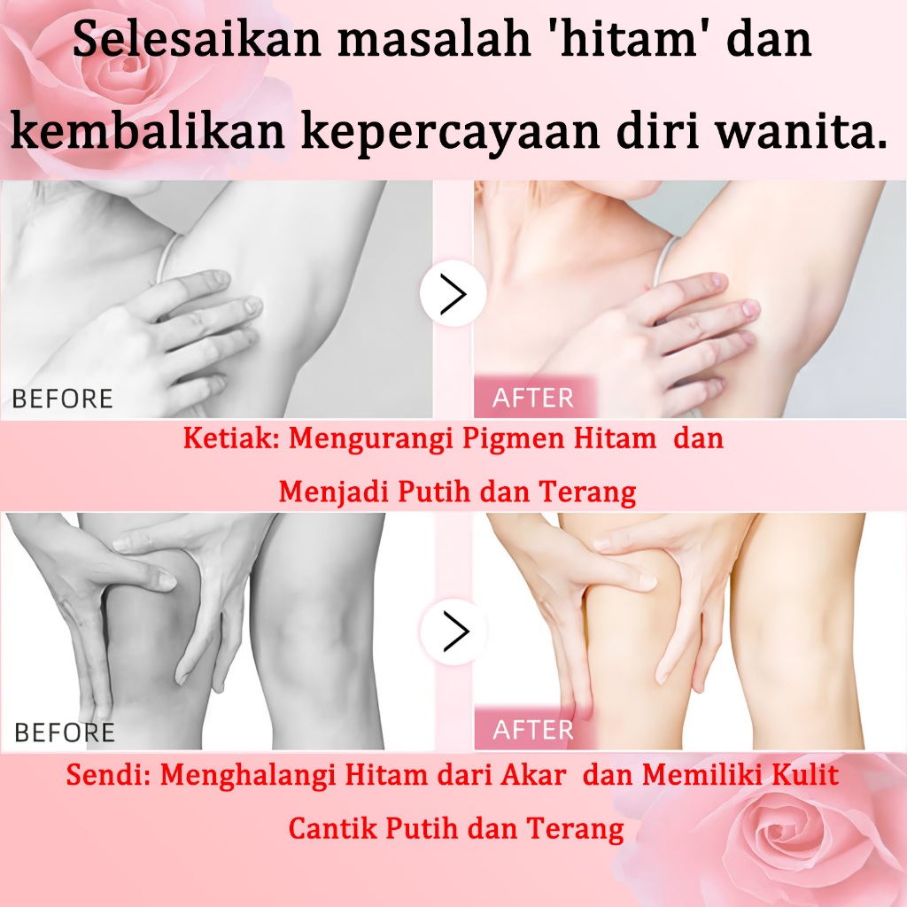 RB salep pemutih selangkangan ampuh Memutihkan selangkangan hitam Cream pemutih selangkangan bpom