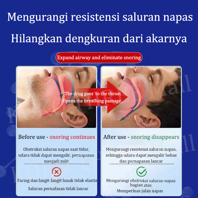 New Anti ngorok saat tidur anti dengkur Anti Mendengkur Anti-snoring patch alat anti ngorok saat