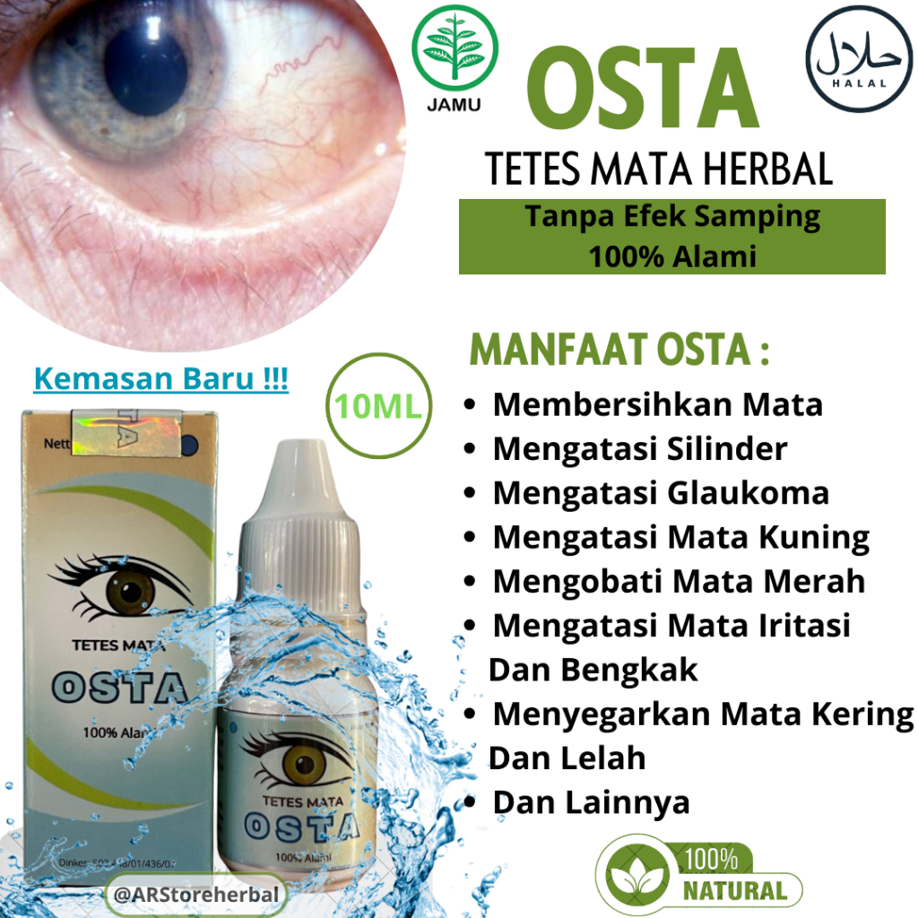 Tetes Mata Gurah Herbal Pembersih Lemak Lamad di Mata, Mata Berlemak Pterygium Katarak Herbal Tanpa 