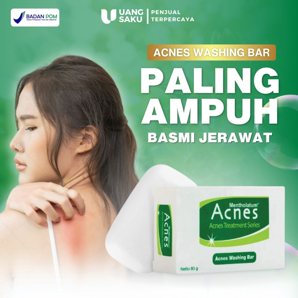 Sabun Jerawat Punggung Badan Dan Pantat Penghilang Bekas Jerawat Untuk Pria Dan Wanita Ampuh