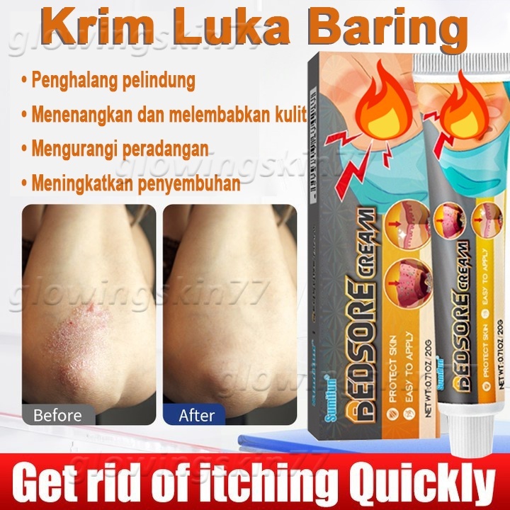 Krim Luka Baring Penyembuhan Luka Luka Diabete Skrim Dekubitus Mengobati Dekubitus 20g Topikal