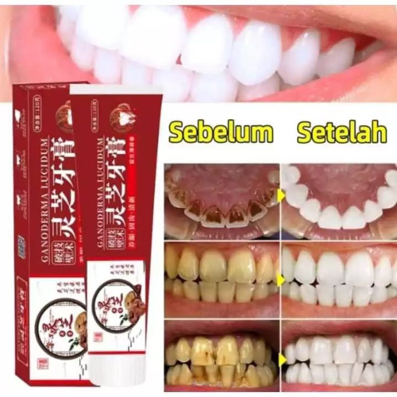 Pasta gigi pembersih karang gigi GANODERMA LUCIDUM