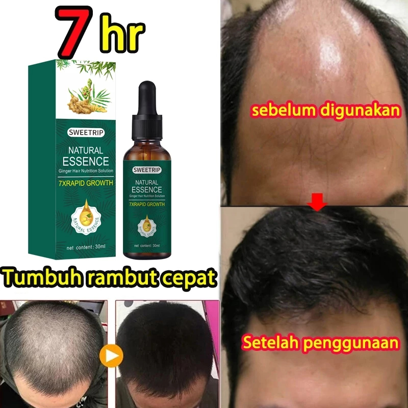 [BALI] Serum Penumbuh Rambut Jahe Natural Essence Ginger Germinal Oil | Minyak Atsiri Alami untuk Ra