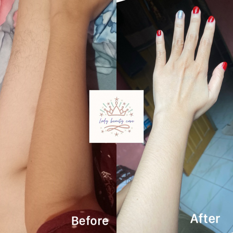 paket glow 5x infus whitening