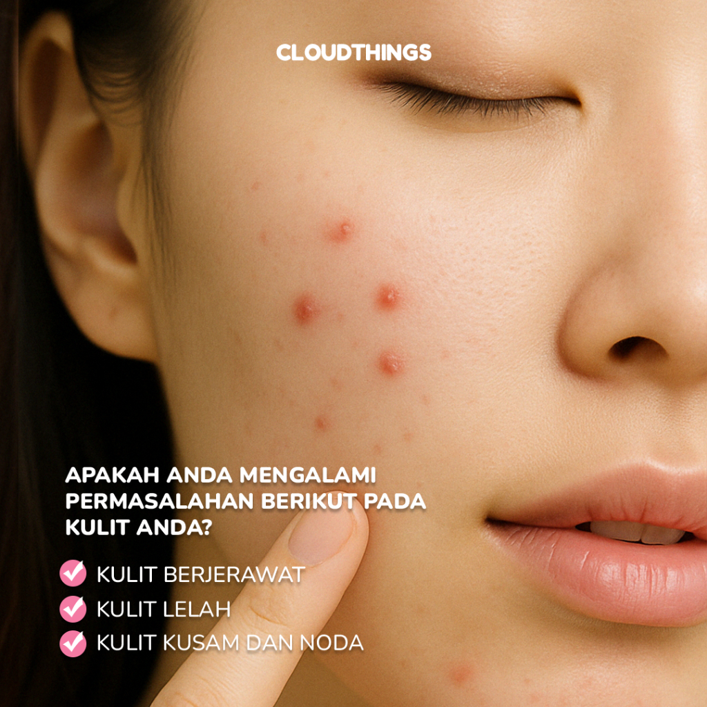 New (FREE BLUSH ON) CLOUDTHINGS - Cherry Blossom Witch Hazel Cleansing Water 200ml Pembersih Makeup,