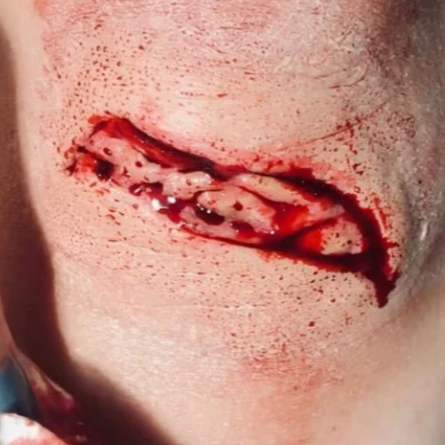 Medium Laceration Prosthetic | Prostetik luka palsu sedang | Fake cut prosthetic | Alat makeup luka 