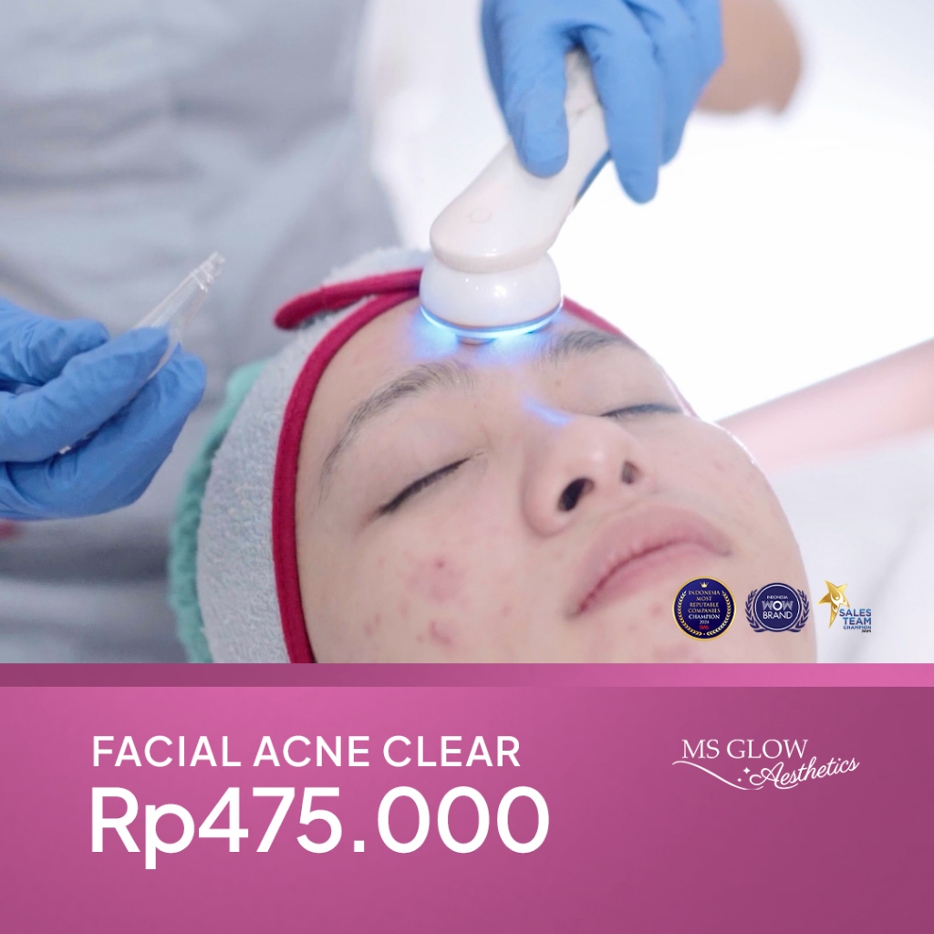 MS Glow Clinic Acne Clear Facial
