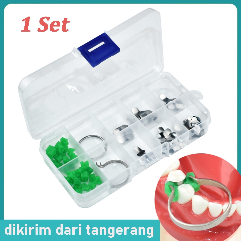 140pcs/box Dental Matrik Sectional Contoured Matrix Metal Ginjal Band Add-On Wedge Dental Matrix Rin