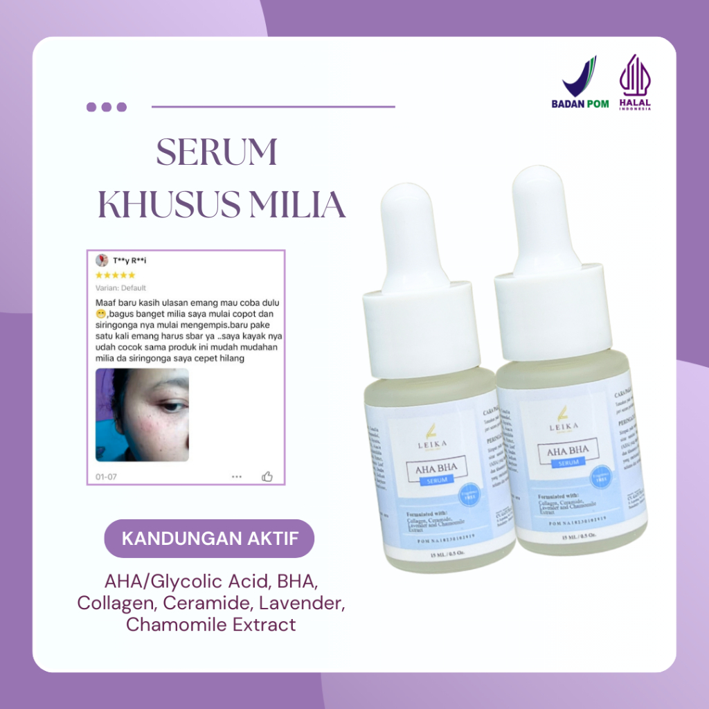 PENGHILANG MILIA DIBAWAH MATA Penghilang Milia Paling Ampuh Penghilang Milia Dikelopak Mata Penghila