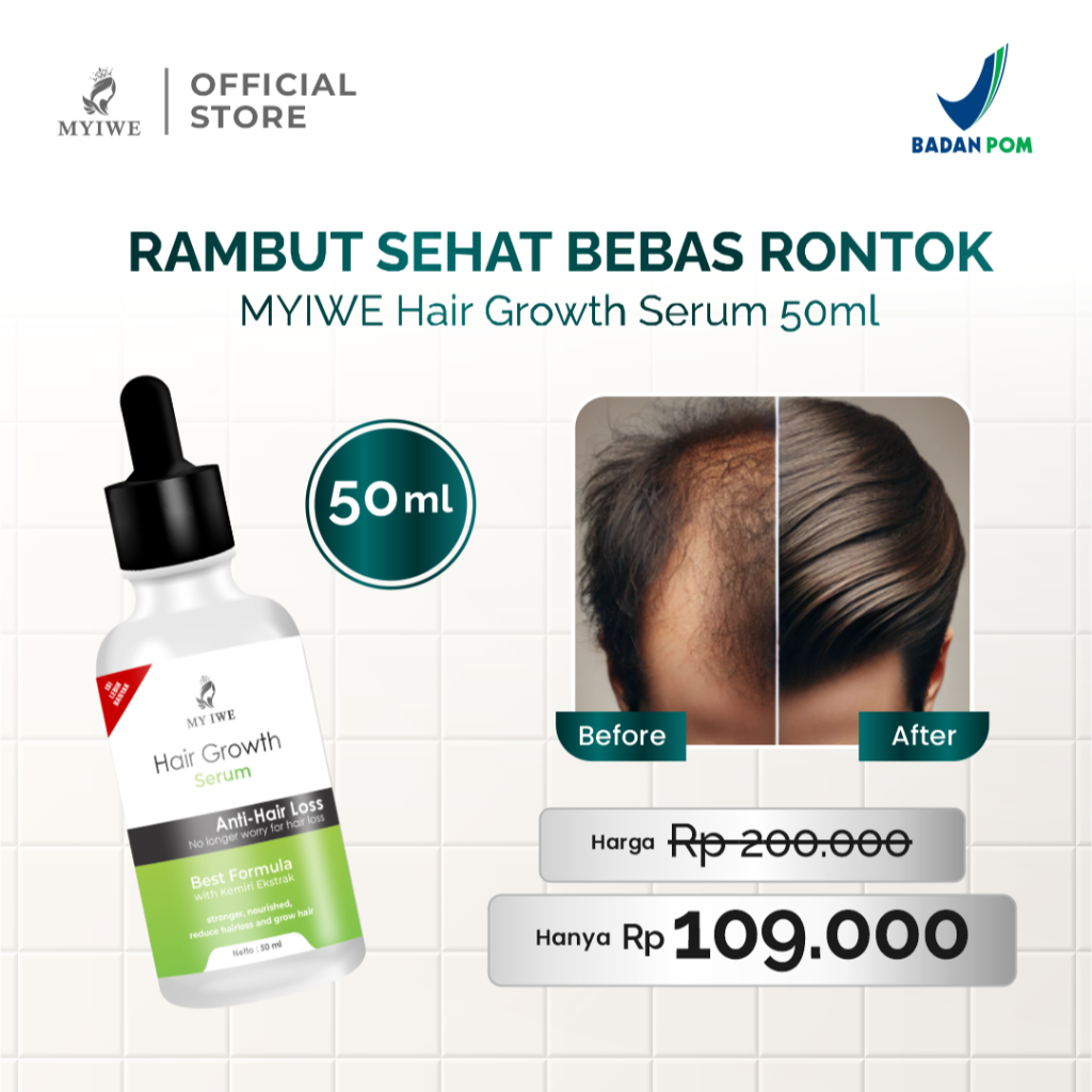 Myiwe Hair Growth Serum Penumbuh Rambut dan Perawatan Rambut Rontok / Hair Serum Vitamin Rambut Ront