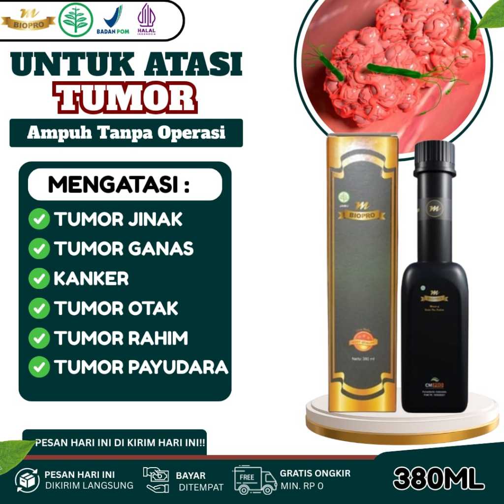 Obat Tumor dan Kanker Paling Ampuh - Tumor Jinak - Tumor  Ganas - Tumor Otak - Tumor Serviks - Benjo