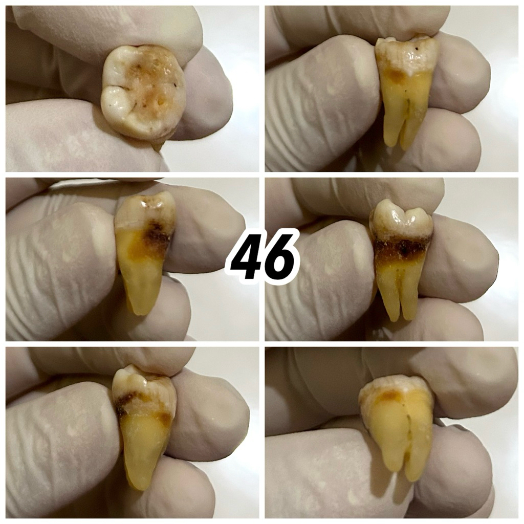 JUAL GIGI ASLI PRAKTIKUM / GIGI MANUSIA / KEDOKTERAN GIGI