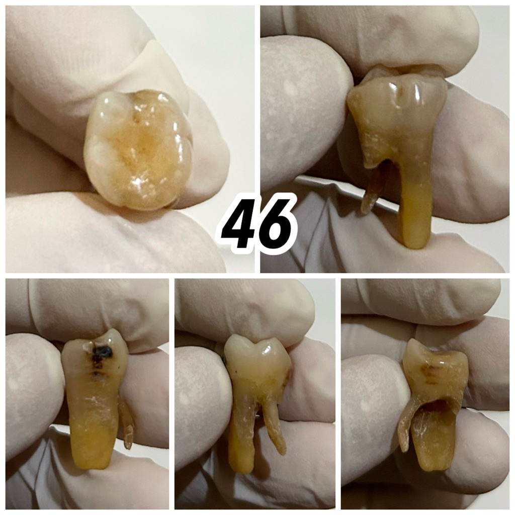 JUAL GIGI ASLI PRAKTIKUM / GIGI MANUSIA / KEDOKTERAN GIGI