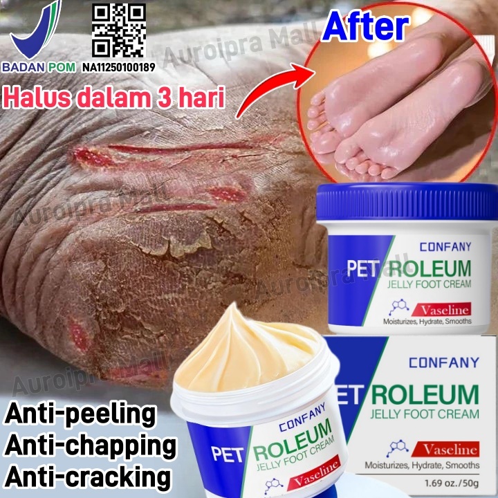 BPOM obat kaki pecah pecah 50g foot cream bahan vaseline perawatan kaki untuk mulus krim tumit kaki 