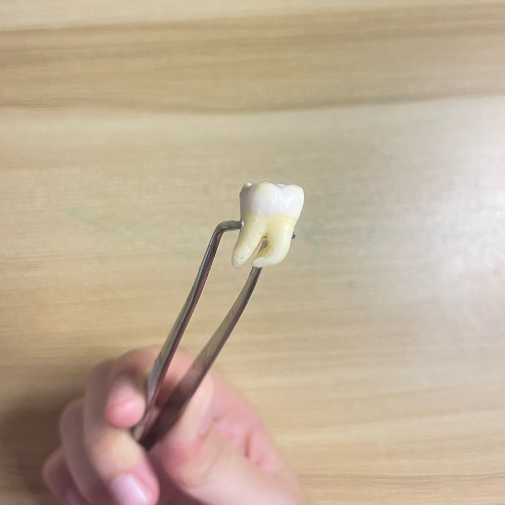 Gigi Molar Rahang Bawah Permanent | Gigi Praktikum | Gigi Molar RB | Gigi Asli