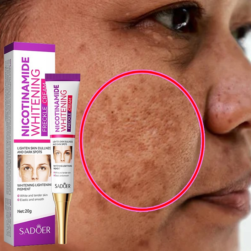 Cream penghilang flek hitam salep flek hitam membandel menghilangkan flek hitam di wajah krim flek h