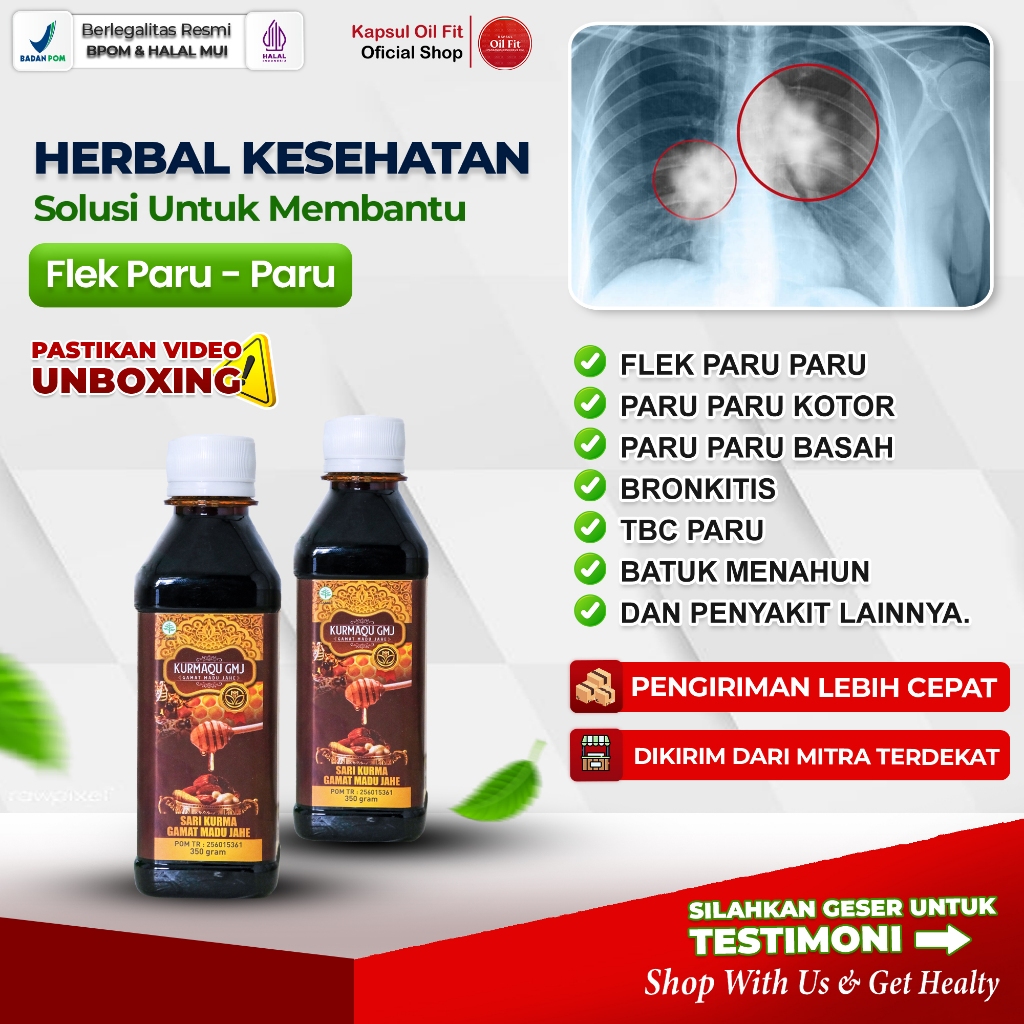 Limited Kurmaqu Sari Kurma Dan Madu Obat Flek Paru Paru Anak Dewasa Ibu Hamil Dan Menyusui Tb Paru
