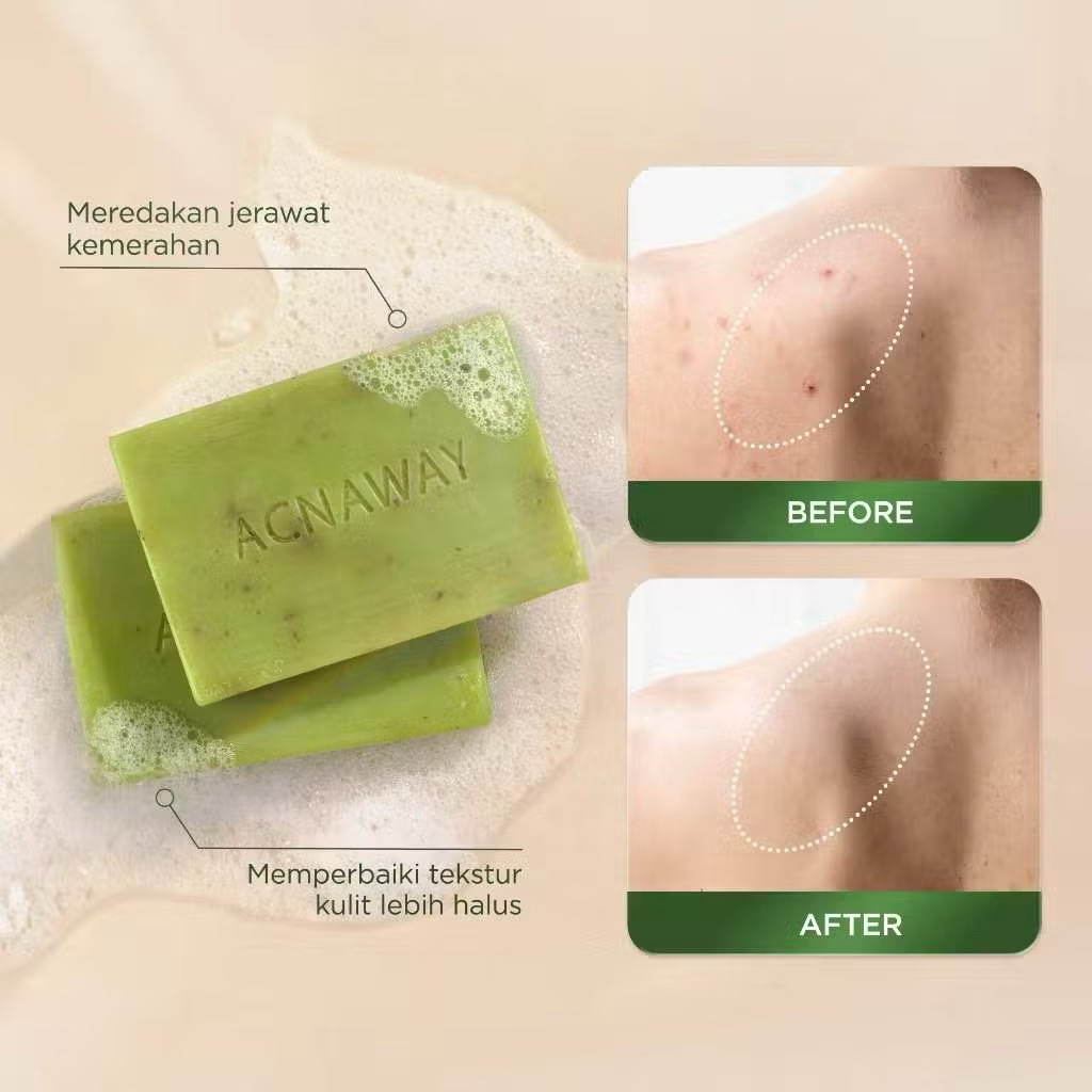 Acnaway Mugwort Acne Clear Bar Soap - Sabun Organik Natural Acne Soap