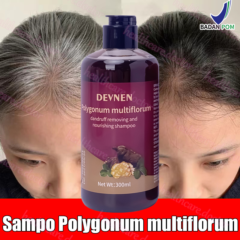 Polygunum Multiflorum Shampo 300ML Sampho Penghitam Rambut Uban Menghitamkan Rambut Beruban Shampo P