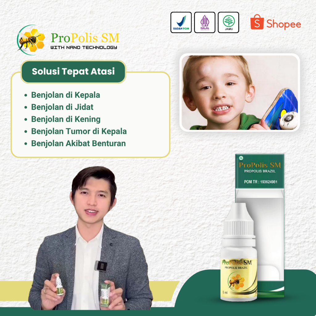 Obat Benjolan di Jidat / Kening, Penghancur Benjolan Tumor, Lipoma, Kista - Propolis SM
