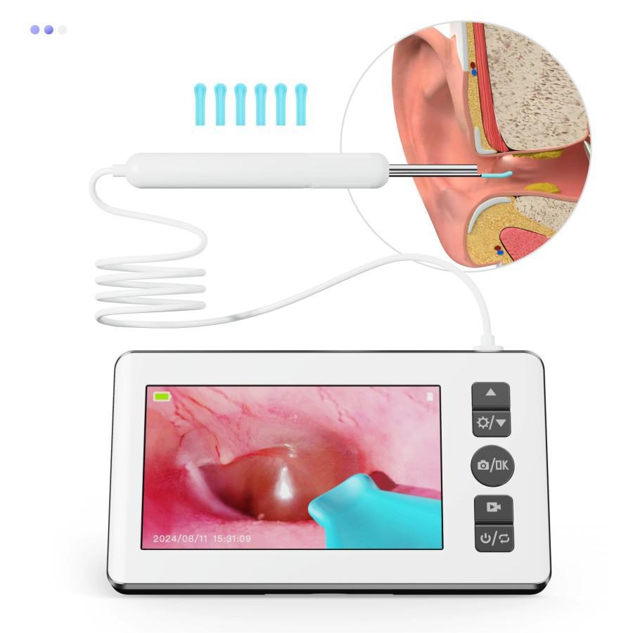 USB Kamera Telinga Hidung Tenggorokan Endoskopi THT LCD Display - HD