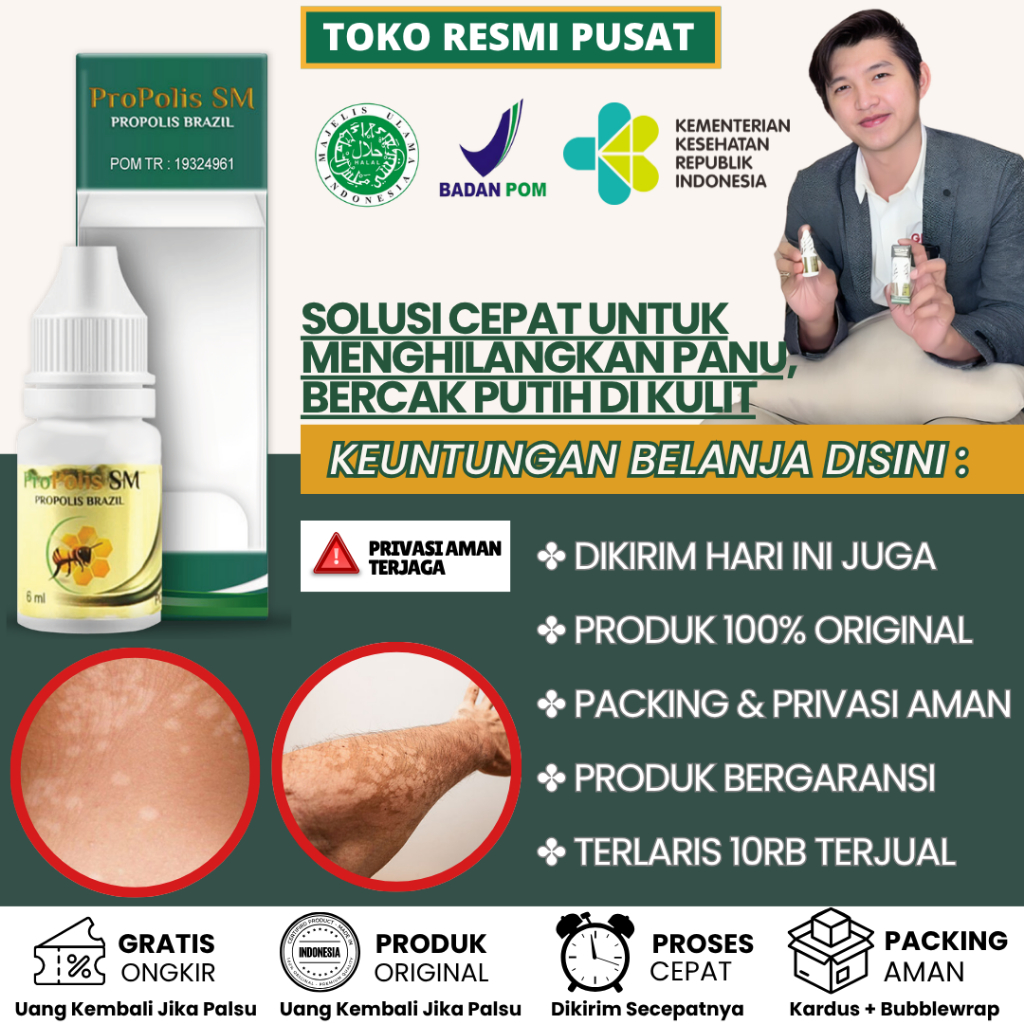 Obat Panu Cair, Penghilang Panu, Obat Panu Anak, Obat Hapur Kulit, Penghilang Panu di Badan di Wajah