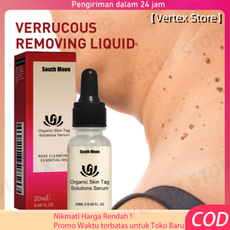 Wart Removal ROSE CLEANSINGESSENTIAL OIL Organic Skin TagSolutions Serum Penghilang Kutil Dan Tahi L