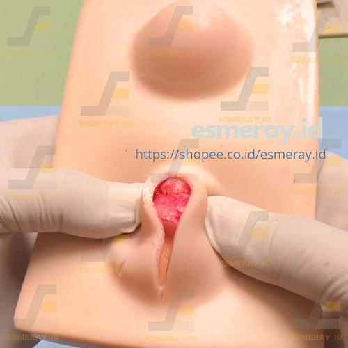 Manekin Latihan Bedah Lipoma-Bahan Silikon untuk Simulasi Praktek Medis-Alat Peraga Model Benjolan